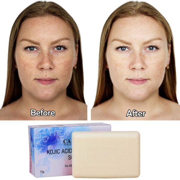 kojic soap face effects